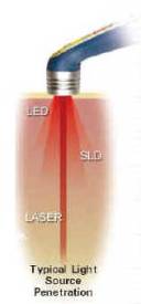 About Laser Light Therapy